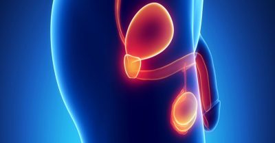 Testis Kanseri İyileşme Oranı Testis Kanseri İyileşme Oranı