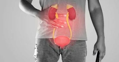 Vasectomy in Men Vasectomy in Men