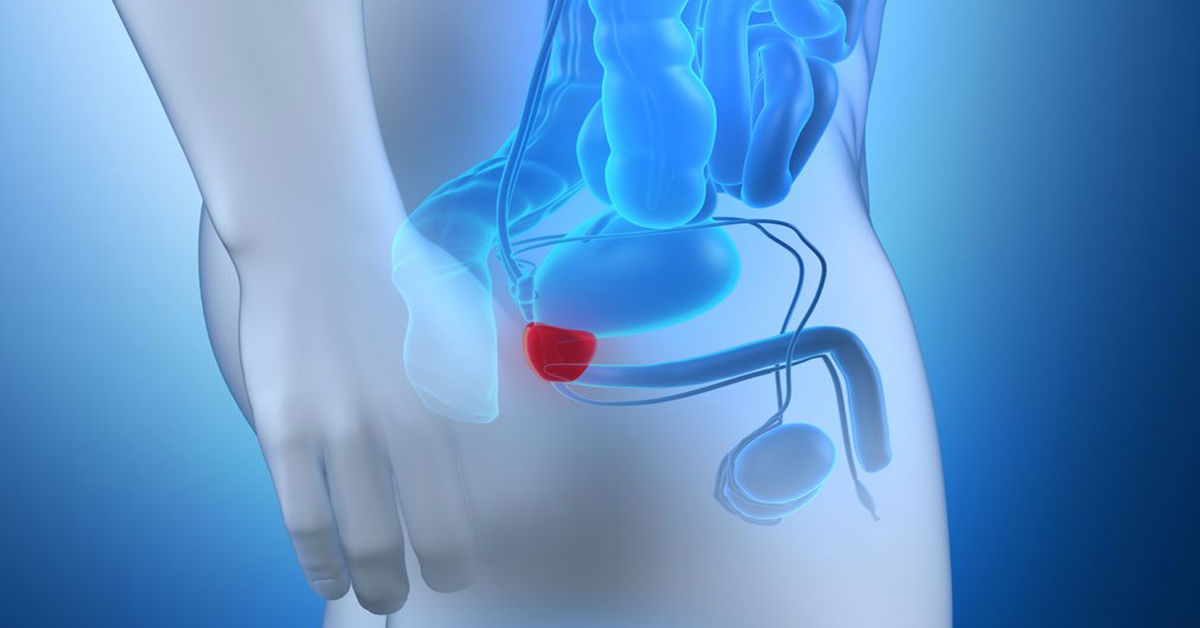 What is Prostate Treatment? What is Prostate Treatment?