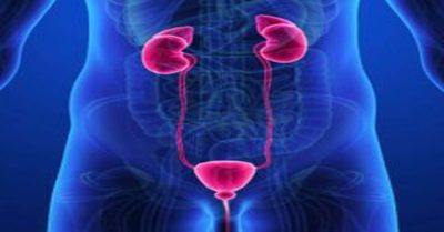 Мочевой конкремент Мочевой конкремент