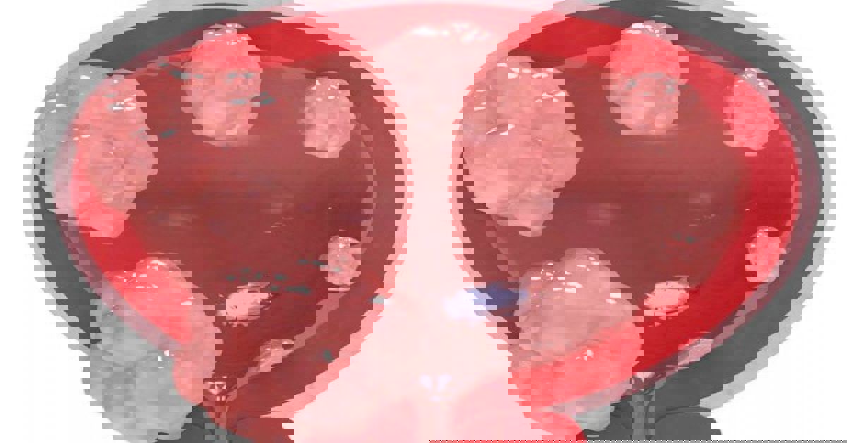 حساب التفاضل والتكامل البولية