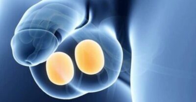 Testis Enfeksiyonu Testis Enfeksiyonu